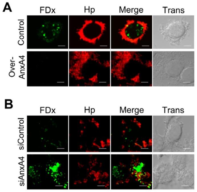 https://cdn.ncbi.nlm.nih.gov/pmc/blobs/da4a/3431852/aac6ac782fd2/ijms-13-10176f4.jpg