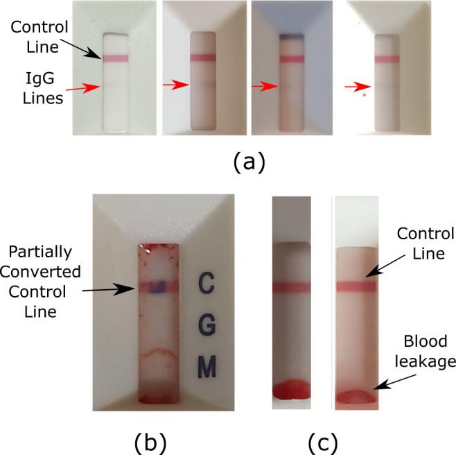 https://cdn.ncbi.nlm.nih.gov/pmc/blobs/da4b/9259560/482556713798/43856_2022_146_Fig2_HTML.jpg