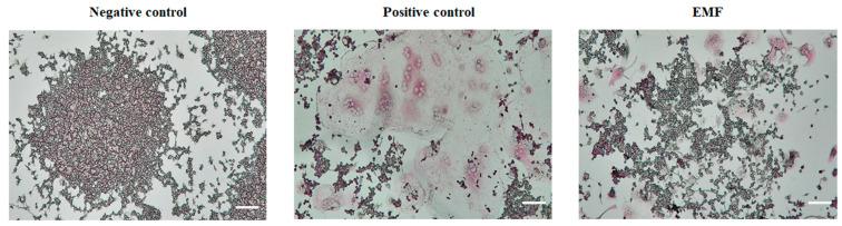 https://cdn.ncbi.nlm.nih.gov/pmc/blobs/da4f/9959640/d8260e90b44b/ijms-24-03058-g002.jpg