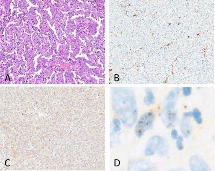 https://cdn.ncbi.nlm.nih.gov/pmc/blobs/da59/12068539/28dfd2f100e1/HED-47-1726-g001.jpg