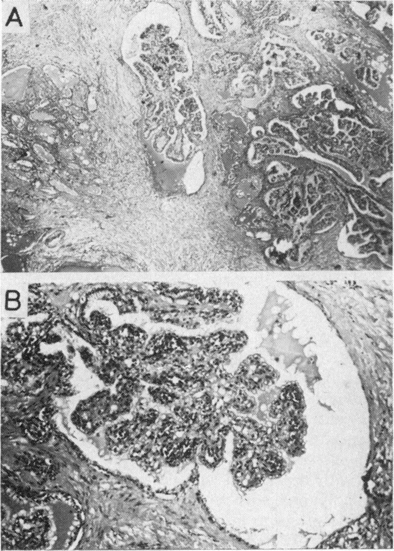 https://cdn.ncbi.nlm.nih.gov/pmc/blobs/da59/1863847/960225eefbc5/procrsmed00041-0072-a.jpg