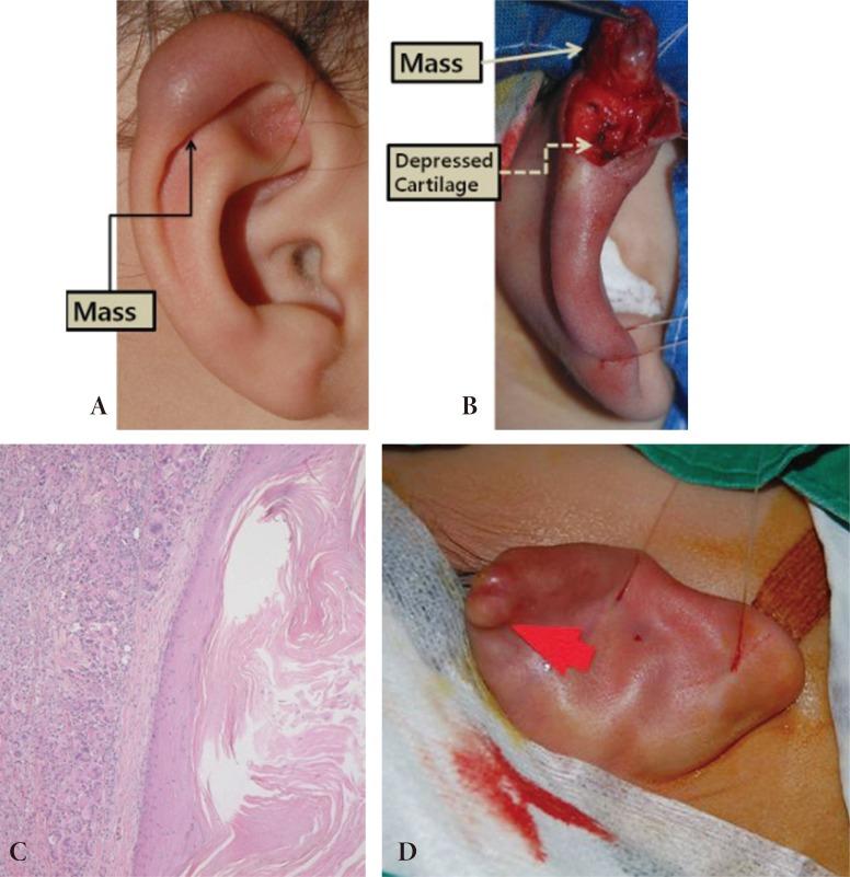 https://cdn.ncbi.nlm.nih.gov/pmc/blobs/da59/5556708/7ea8c5debb7c/acfs-15-22-g001.jpg