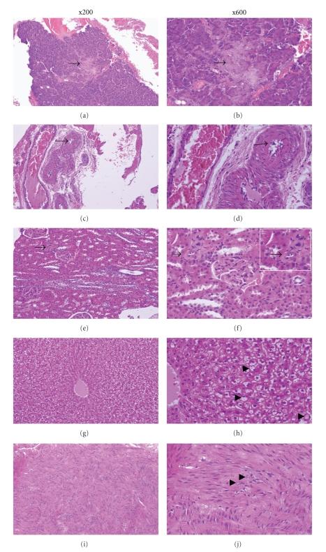 https://cdn.ncbi.nlm.nih.gov/pmc/blobs/da5a/3014707/bc8b73a13ec8/EDR2010-289614.005.jpg