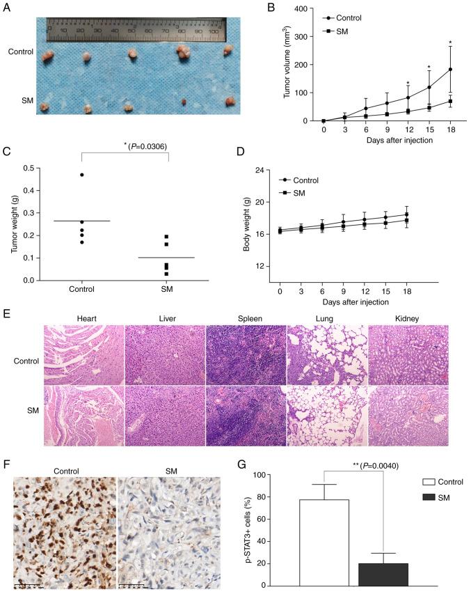 https://cdn.ncbi.nlm.nih.gov/pmc/blobs/da61/10579987/e1bd0ac2ae62/ol-26-05-14080-g06.jpg