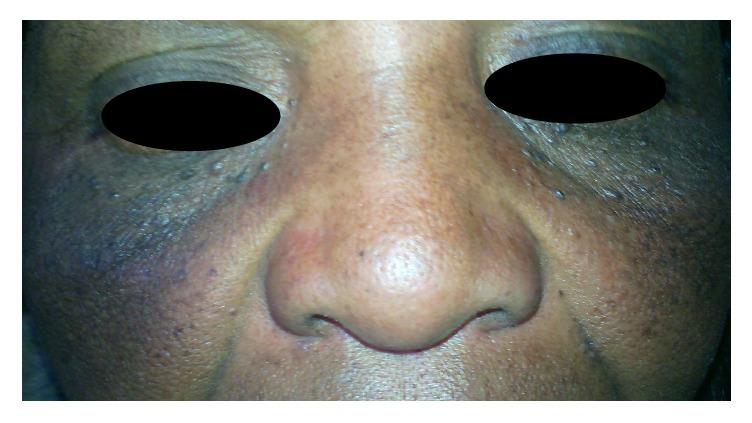 https://cdn.ncbi.nlm.nih.gov/pmc/blobs/da6a/5585578/9272491b919e/BMRI2017-9637083.002.jpg