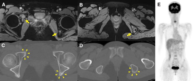 https://cdn.ncbi.nlm.nih.gov/pmc/blobs/da6c/10344532/0afc82e5cdfd/medi-102-e34196-g001.jpg