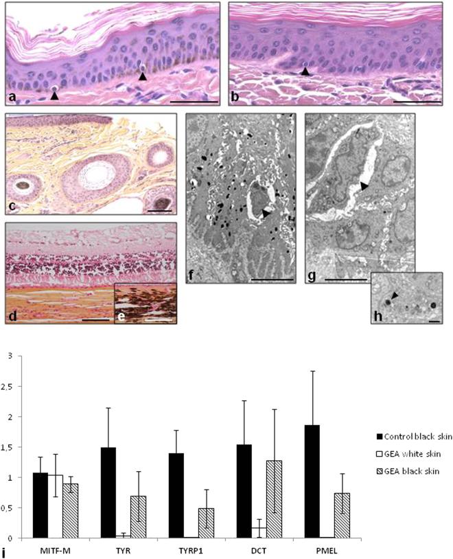 https://cdn.ncbi.nlm.nih.gov/pmc/blobs/da71/5597596/1b099297cf61/41598_2017_11523_Fig3_HTML.jpg