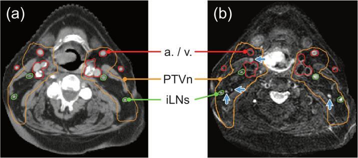 https://cdn.ncbi.nlm.nih.gov/pmc/blobs/da75/8829887/57dd63dbc368/gr1.jpg