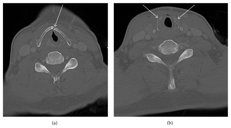 https://cdn.ncbi.nlm.nih.gov/pmc/blobs/da81/4363638/ca6cbccba9df/CRIOT2015-393978.001.jpg