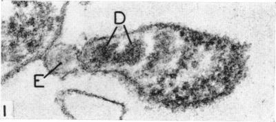 https://cdn.ncbi.nlm.nih.gov/pmc/blobs/da88/277426/b81d67a0db9f/jbacter00439-0259-a.jpg
