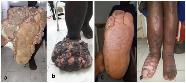 https://cdn.ncbi.nlm.nih.gov/pmc/blobs/da92/7857577/133cb9e78740/pntd.0009053.g001.jpg