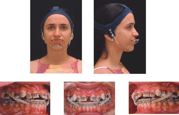 https://cdn.ncbi.nlm.nih.gov/pmc/blobs/da9b/5349060/01af98ff3fa1/jaos-18-03-0308-g04.jpg