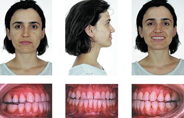 https://cdn.ncbi.nlm.nih.gov/pmc/blobs/da9b/5349060/1025303ffe6a/jaos-18-03-0308-g01.jpg