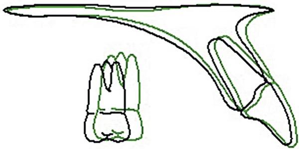 https://cdn.ncbi.nlm.nih.gov/pmc/blobs/da9b/5349060/71faeb5acbbc/jaos-18-03-0308-g08.jpg