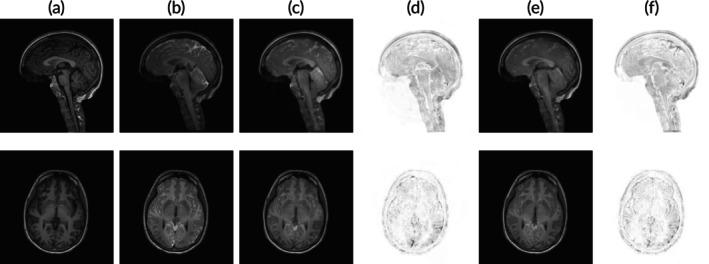 https://cdn.ncbi.nlm.nih.gov/pmc/blobs/da9e/11996590/01d81bd4befc/NBM-38-e70029-g005.jpg