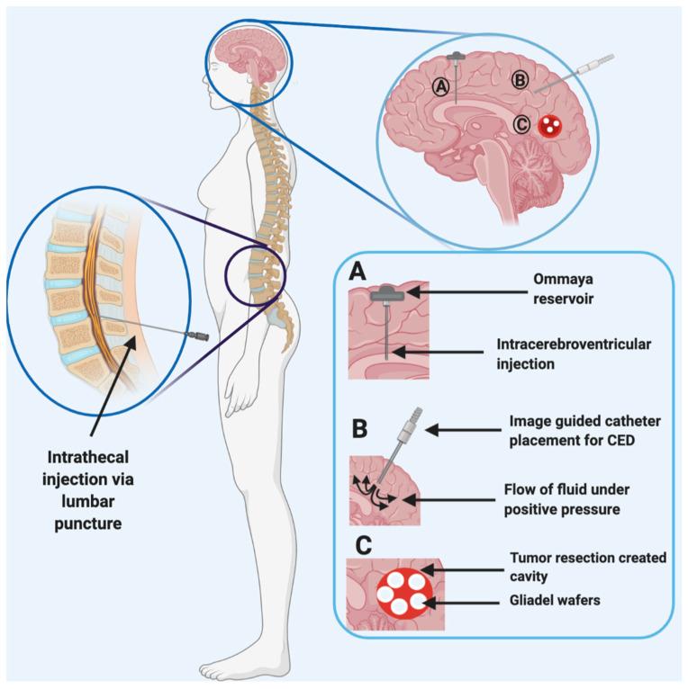 https://cdn.ncbi.nlm.nih.gov/pmc/blobs/daa0/7763839/4c7106c3782e/pharmaceutics-12-01205-g003.jpg
