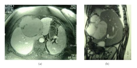 https://cdn.ncbi.nlm.nih.gov/pmc/blobs/daa4/2705982/6d27b1c9f67c/HPB2009-407206.001.jpg