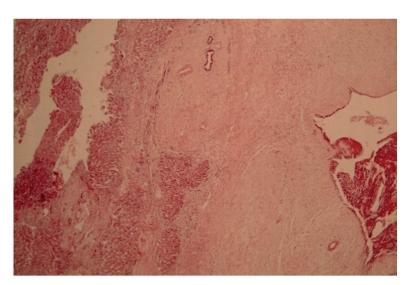 https://cdn.ncbi.nlm.nih.gov/pmc/blobs/daa4/2705982/8c7f107b7e2b/HPB2009-407206.002.jpg