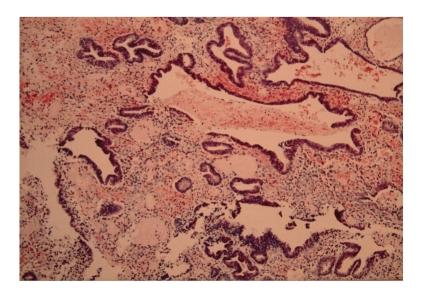https://cdn.ncbi.nlm.nih.gov/pmc/blobs/daa4/2705982/f3d82140a3e9/HPB2009-407206.003.jpg