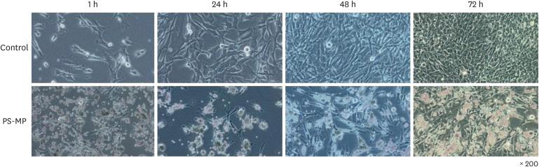 https://cdn.ncbi.nlm.nih.gov/pmc/blobs/daa6/11458380/7a592ac83712/jkms-39-e259-g001.jpg