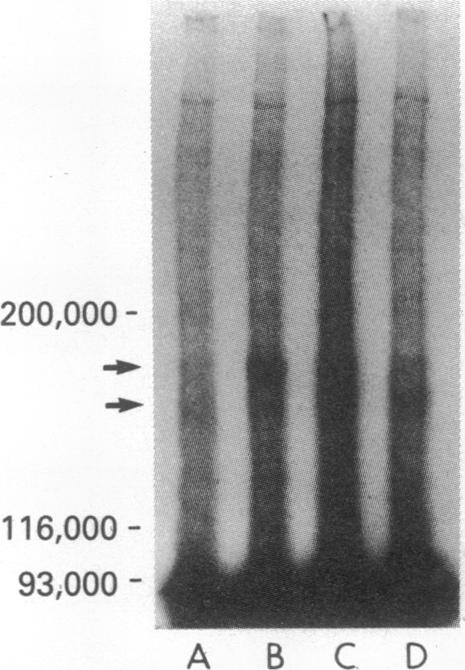 https://cdn.ncbi.nlm.nih.gov/pmc/blobs/daa9/346659/8eab2cf37d41/pnas00453-0085-c.jpg