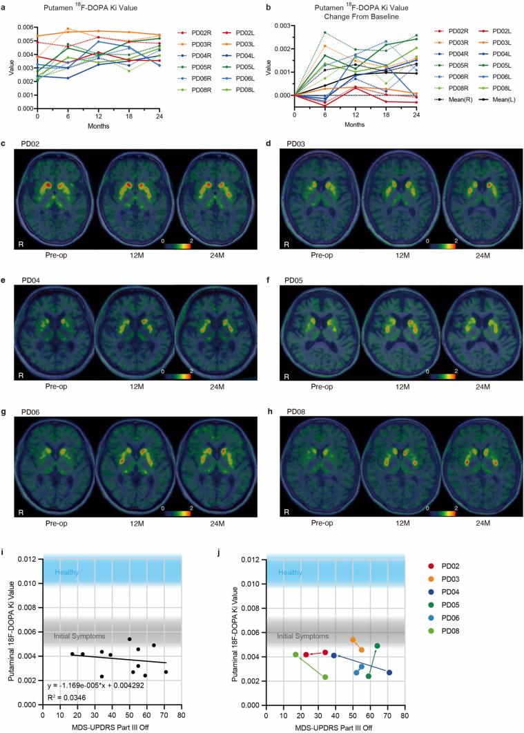 https://cdn.ncbi.nlm.nih.gov/pmc/blobs/dabd/12095070/56c34ecce369/41586_2025_8700_Fig9_ESM.jpg