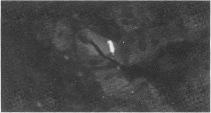 https://cdn.ncbi.nlm.nih.gov/pmc/blobs/dabd/1420256/59f1a025738b/gut00409-0106-c.jpg