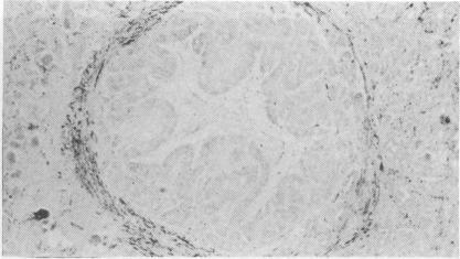https://cdn.ncbi.nlm.nih.gov/pmc/blobs/dabd/1420256/f1377f3b19e4/gut00409-0105-d.jpg