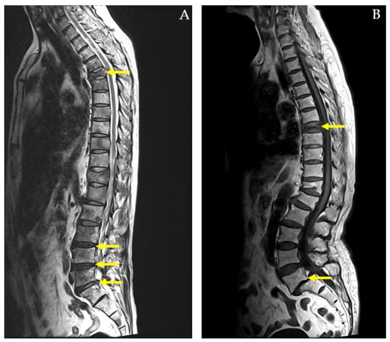 https://cdn.ncbi.nlm.nih.gov/pmc/blobs/dac4/11545723/b0a72ff94052/diagnostics-14-02456-g004.jpg