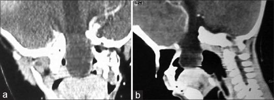 https://cdn.ncbi.nlm.nih.gov/pmc/blobs/dac7/6159010/bd5dc8696a30/AJNS-13-782-g001.jpg