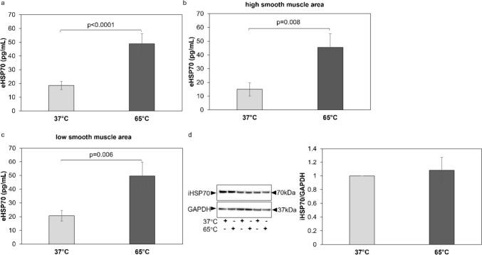 https://cdn.ncbi.nlm.nih.gov/pmc/blobs/dace/11143057/054a57d3d01d/408_2024_680_Fig1_HTML.jpg