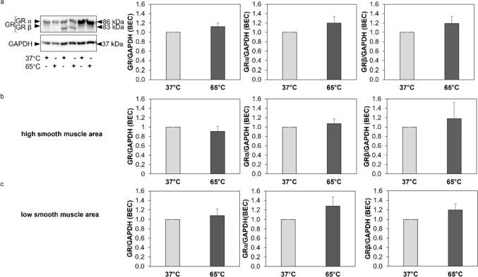 https://cdn.ncbi.nlm.nih.gov/pmc/blobs/dace/11143057/859d22a2a811/408_2024_680_Fig3_HTML.jpg