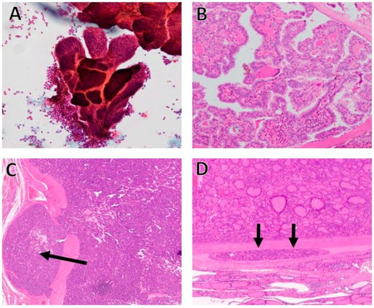https://cdn.ncbi.nlm.nih.gov/pmc/blobs/dace/12427551/7ab0bb871648/cancers-17-02869-g001.jpg
