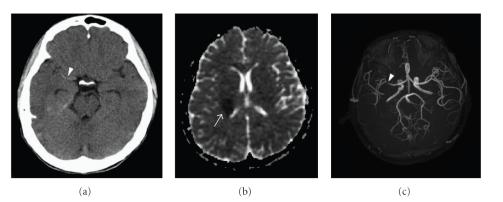 https://cdn.ncbi.nlm.nih.gov/pmc/blobs/dace/3038616/f8e7b3292c6e/SRT2011-432839.004.jpg