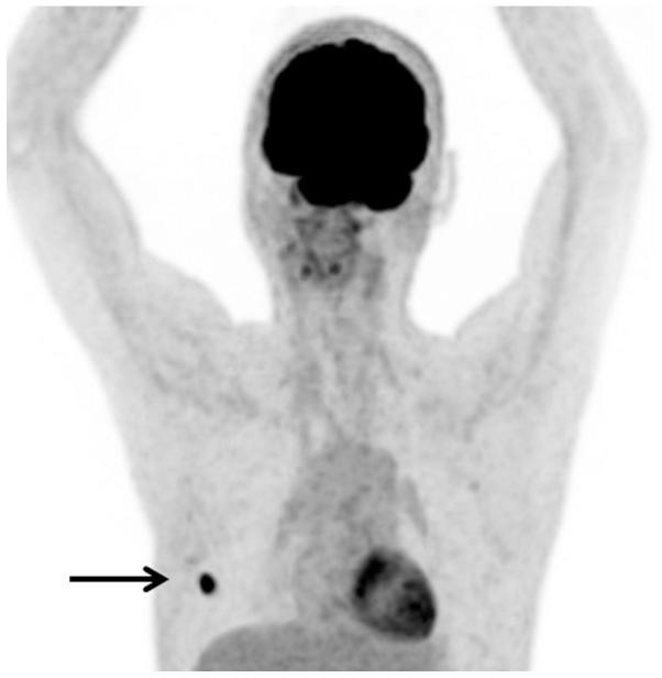 https://cdn.ncbi.nlm.nih.gov/pmc/blobs/dad0/4356394/0e1d3acd005f/OL-09-04-1814-g03.jpg