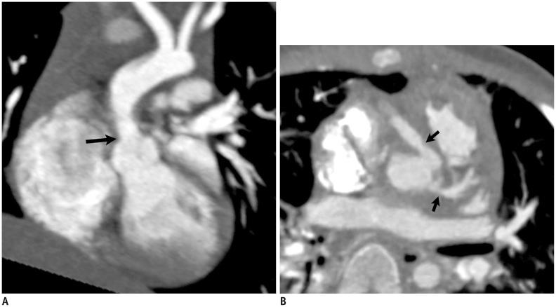 https://cdn.ncbi.nlm.nih.gov/pmc/blobs/dada/4347262/31b4f4cfc494/kjr-16-239-g009.jpg
