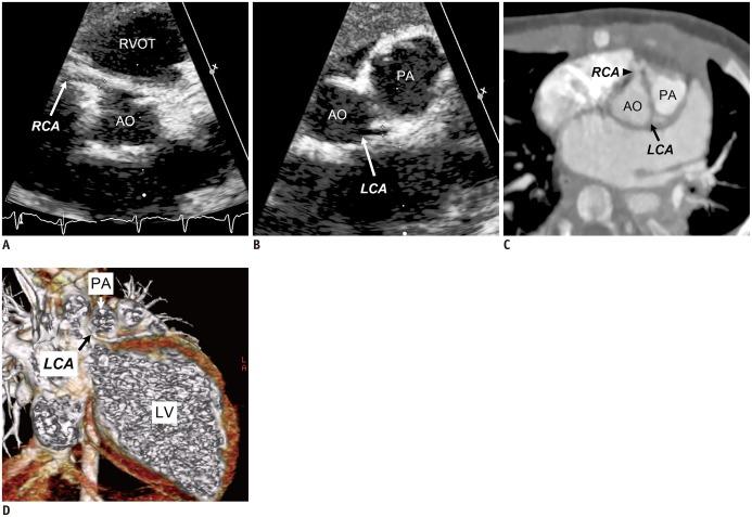 https://cdn.ncbi.nlm.nih.gov/pmc/blobs/dada/4347262/6ccf42397999/kjr-16-239-g001.jpg