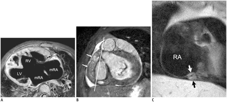 https://cdn.ncbi.nlm.nih.gov/pmc/blobs/dada/4347262/a2d1b92d24bf/kjr-16-239-g006.jpg