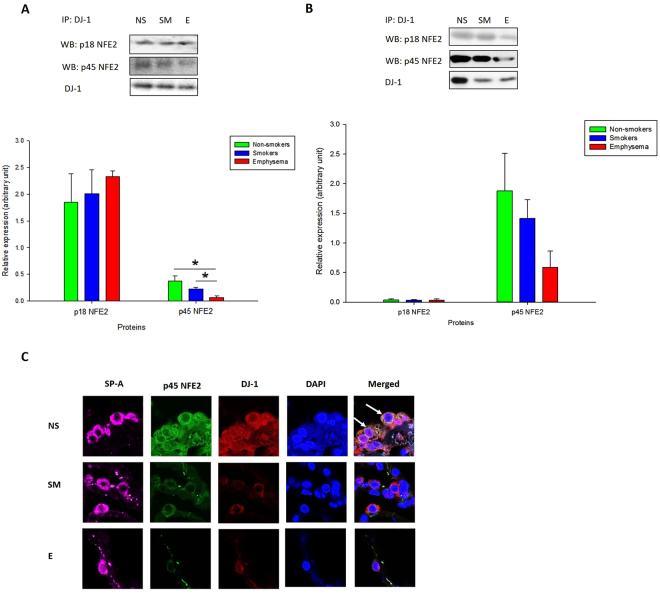https://cdn.ncbi.nlm.nih.gov/pmc/blobs/dadf/5824795/5b464d606dd0/41598_2018_21790_Fig4_HTML.jpg