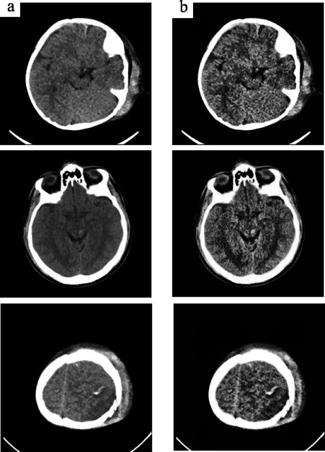 https://cdn.ncbi.nlm.nih.gov/pmc/blobs/dae6/12085612/8957327af802/41598_2025_1317_Fig3_HTML.jpg