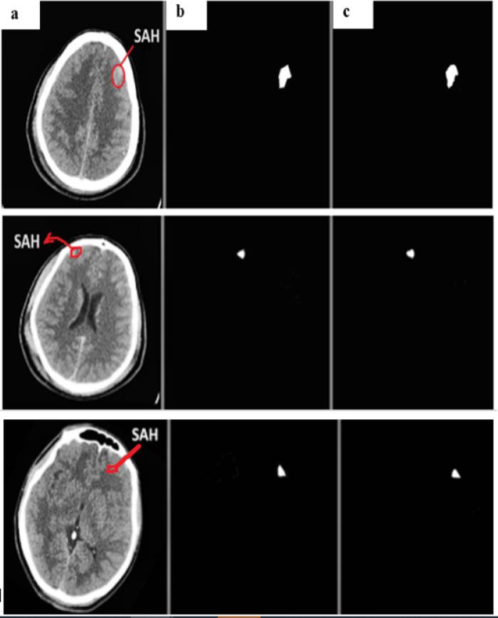 https://cdn.ncbi.nlm.nih.gov/pmc/blobs/dae6/12085612/9e8d322dcbc9/41598_2025_1317_Fig12_HTML.jpg