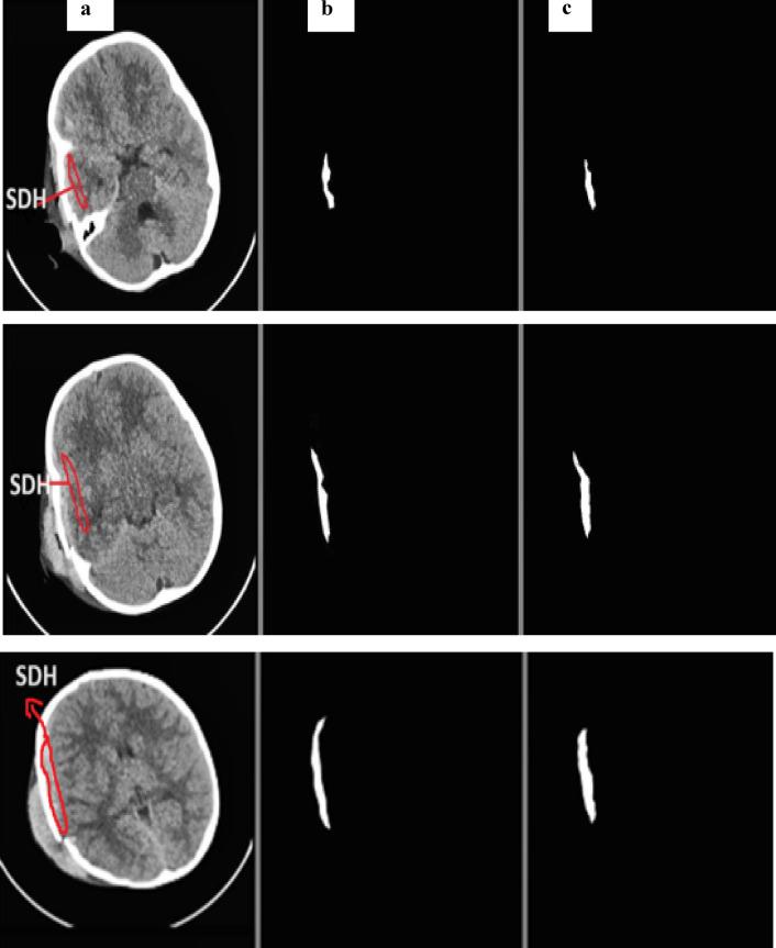https://cdn.ncbi.nlm.nih.gov/pmc/blobs/dae6/12085612/ab1410515a1e/41598_2025_1317_Fig13_HTML.jpg