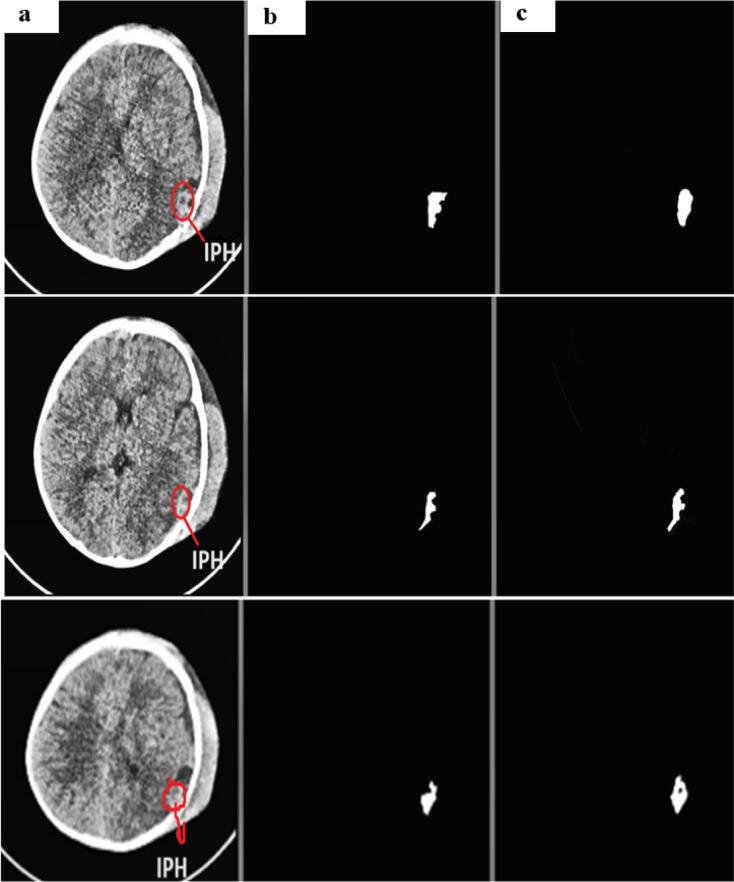 https://cdn.ncbi.nlm.nih.gov/pmc/blobs/dae6/12085612/b3dce0324234/41598_2025_1317_Fig11_HTML.jpg