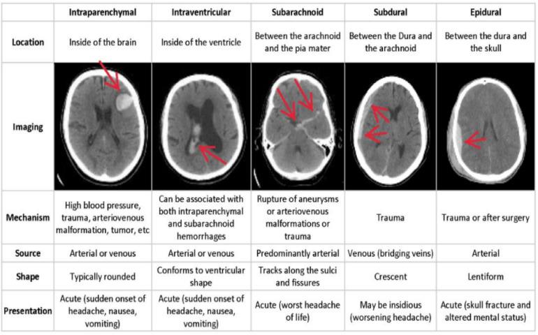 https://cdn.ncbi.nlm.nih.gov/pmc/blobs/dae6/12085612/cfdc36b60132/41598_2025_1317_Fig1_HTML.jpg