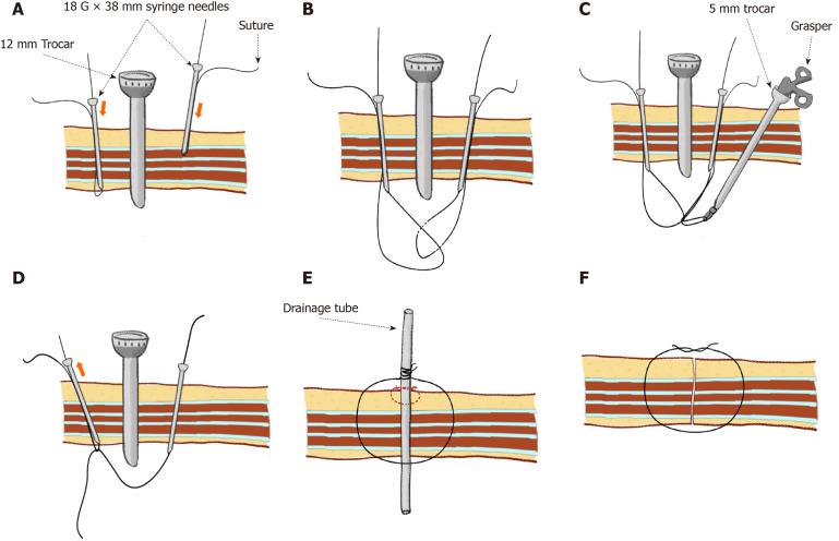 https://cdn.ncbi.nlm.nih.gov/pmc/blobs/dae7/7760453/74c326d51e9a/WJCC-8-6504-g002.jpg
