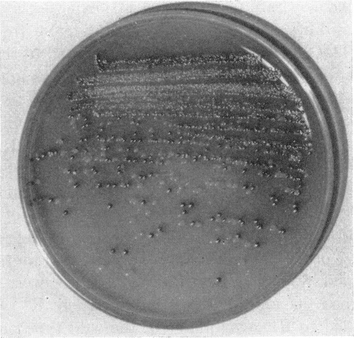 https://cdn.ncbi.nlm.nih.gov/pmc/blobs/daeb/289834/c67defede723/jbacter00522-0065-b.jpg