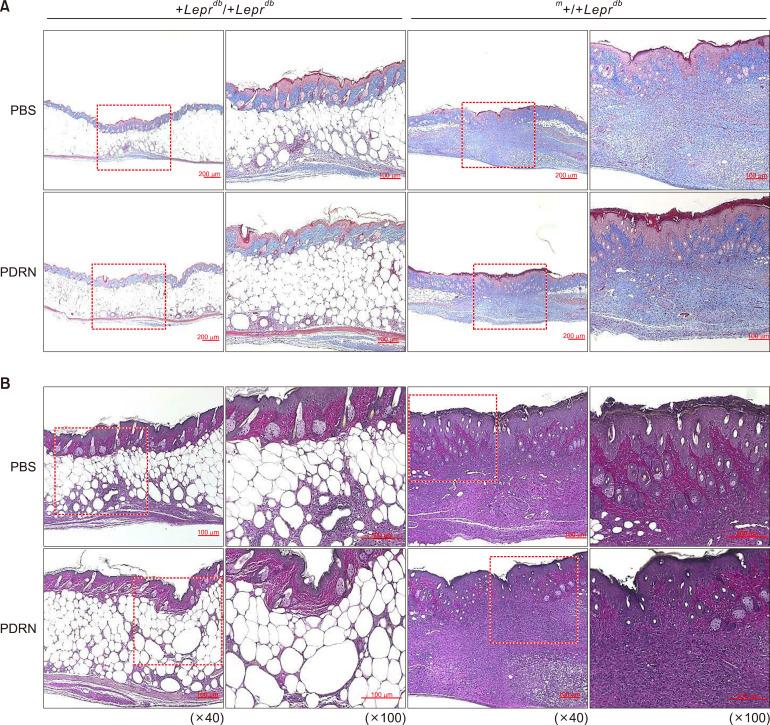 https://cdn.ncbi.nlm.nih.gov/pmc/blobs/daec/7992745/b0949e980b92/ad-31-403-g005.jpg