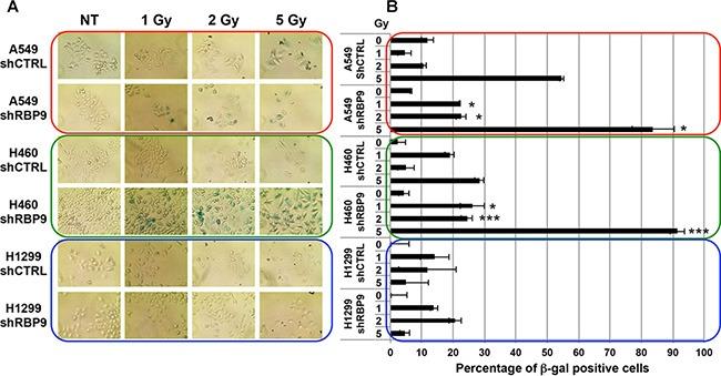 https://cdn.ncbi.nlm.nih.gov/pmc/blobs/daf3/4951294/e70c9f6d73c3/oncotarget-07-18371-g005.jpg