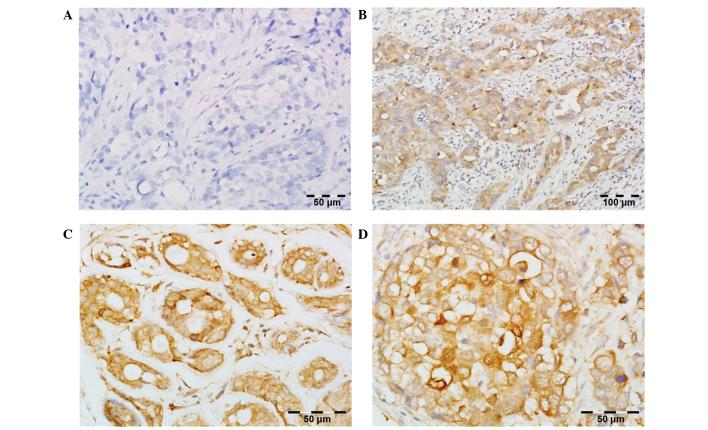 https://cdn.ncbi.nlm.nih.gov/pmc/blobs/daf7/4998224/b24016130eb1/ol-12-03-1667-g00.jpg