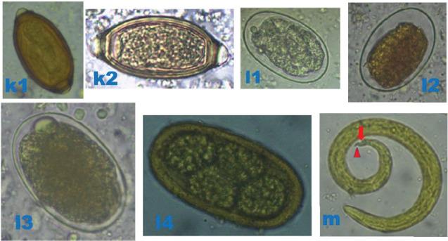 https://cdn.ncbi.nlm.nih.gov/pmc/blobs/dafd/12373475/1802259d311b/JPR2025-9972163.006.jpg